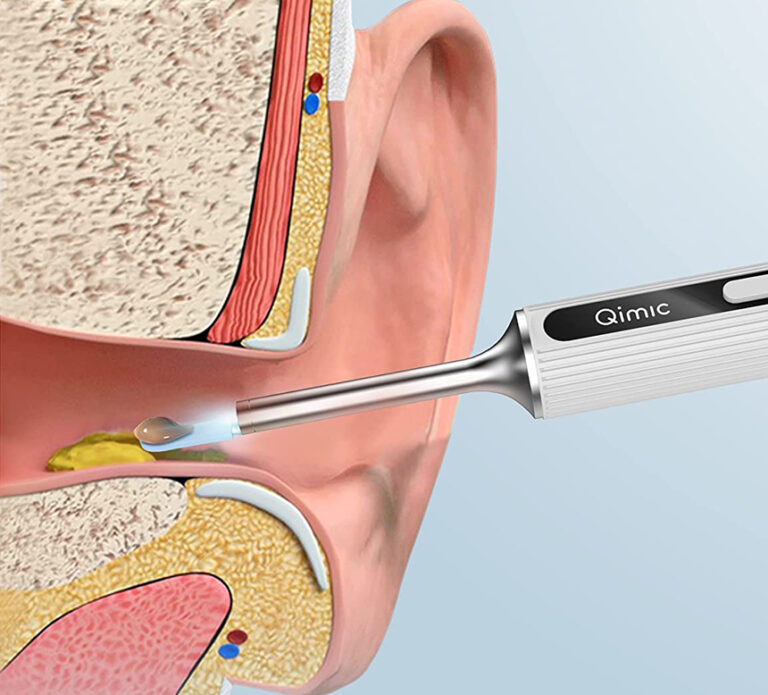 Les 6 Meilleurs Appareils Pour Nettoyer Les Oreilles Les Avis (Printemps 2024)
